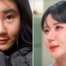 Janubiy Koreyalik ayol 15 yilda 400 jarrohlik qilgan