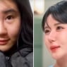Janubiy Koreyalik ayol 15 yilda 400 jarrohlik qilgan