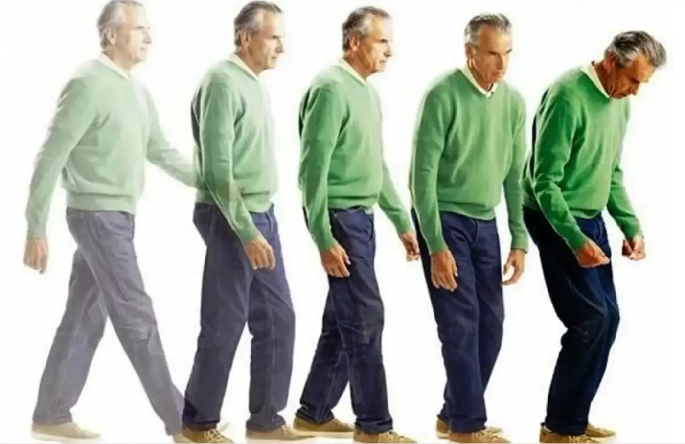 Parkinson can now be diagnosed in living patients: A new breakthrough in medicine from Chinese scientists