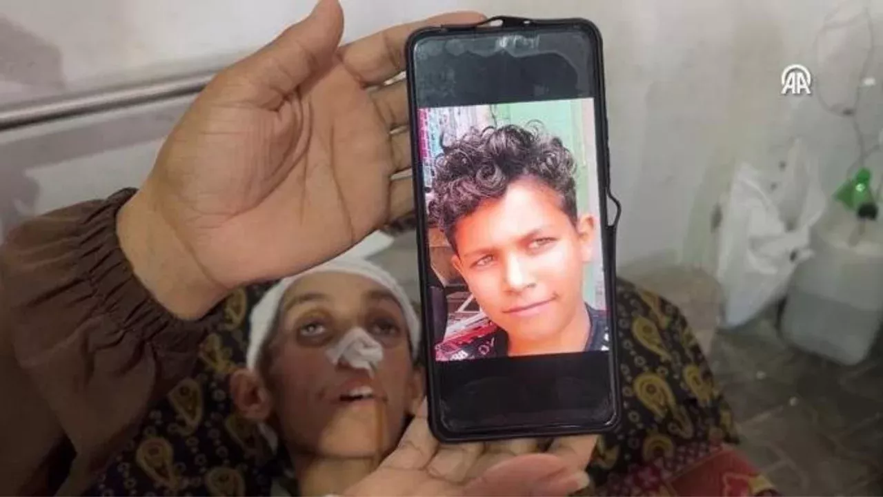 Airstrike in Gaza left Musab disabled