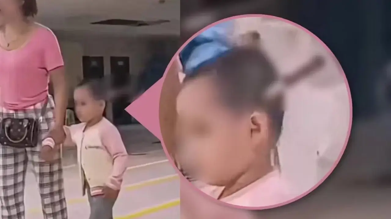 В Куньмине у 3-летней девочки удалили нож из головы