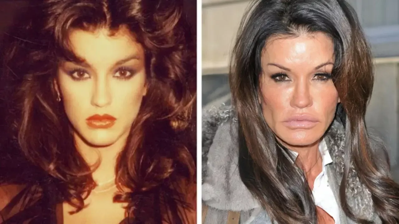 Celebrities changed appearance after plastic surgery