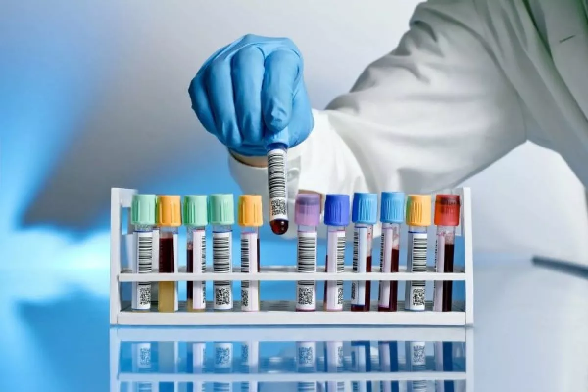 O‘zbekistonda laboratoriya tizimi 2030 yilga isloh qilinadi