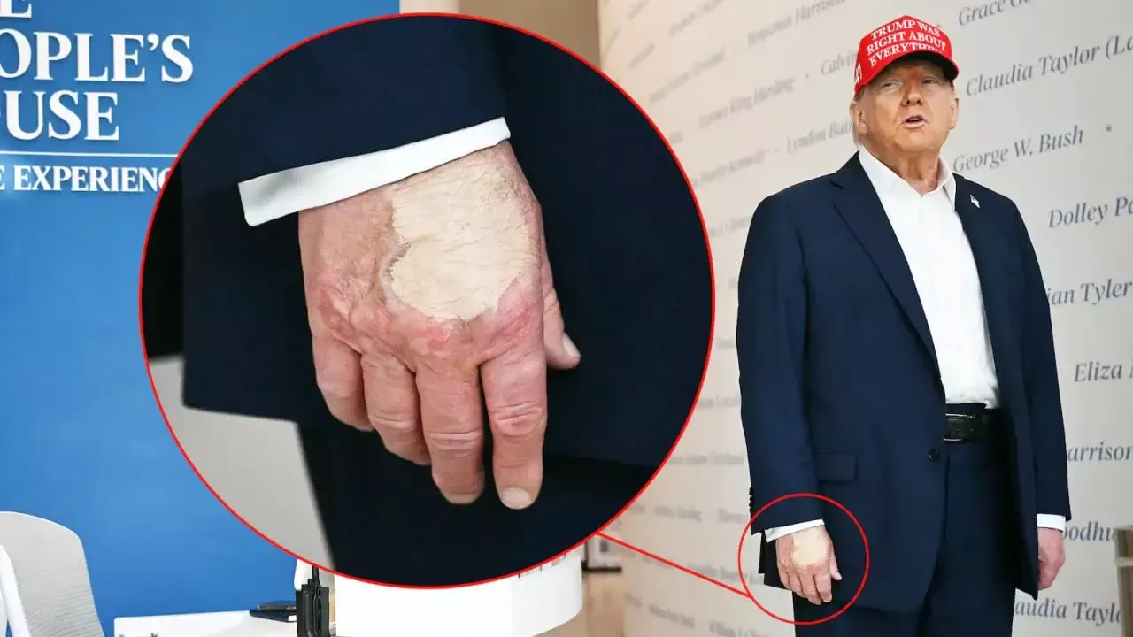 The cream in Trump's hand raised questions about health