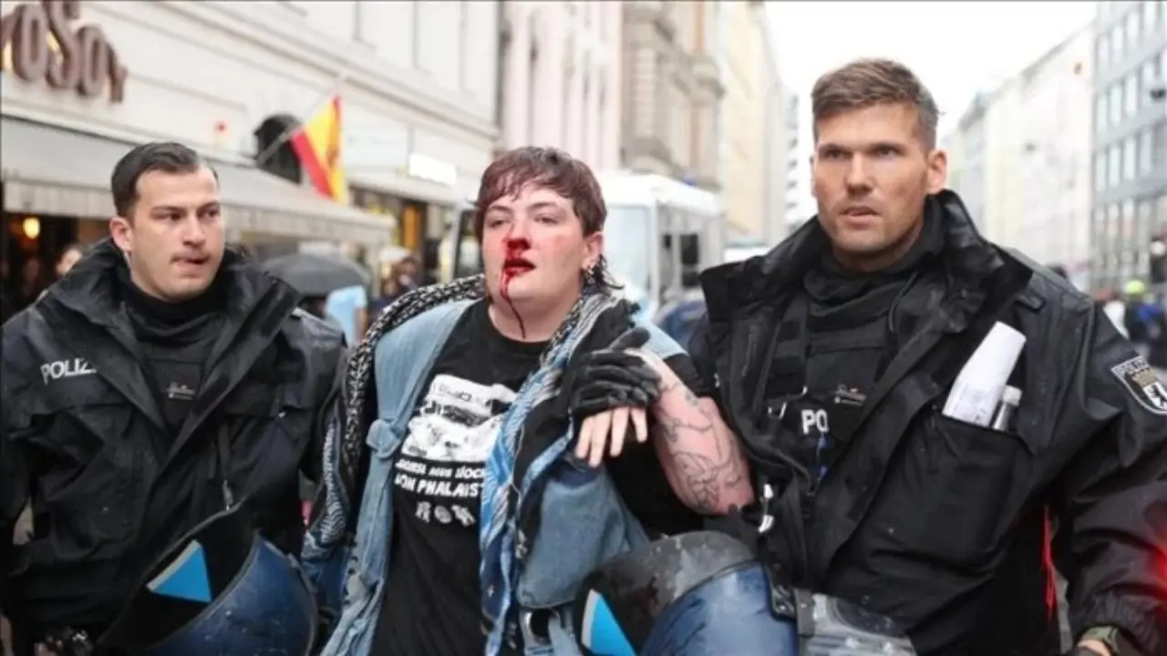 Berlin namoyishida irlandiyalik faollar politsiya zo‘ravonligi haqida shikoyat qildi