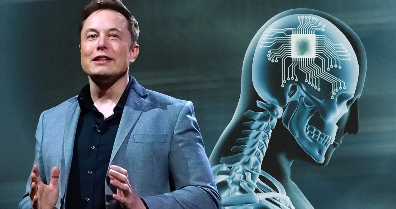 Neuralink nutq muammosi uchun chip sinovini boshlaydi