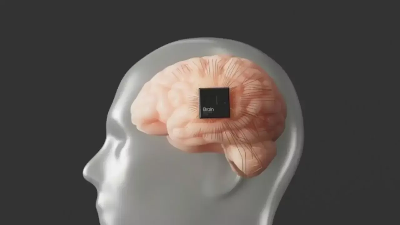 Neuralink 12 kishining miyaga implant o‘rnatdi