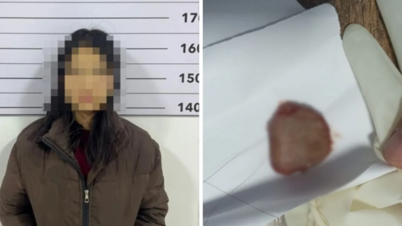 Qirg‘izistonda qiz o‘pish chog‘ida yigit tilini tishladi