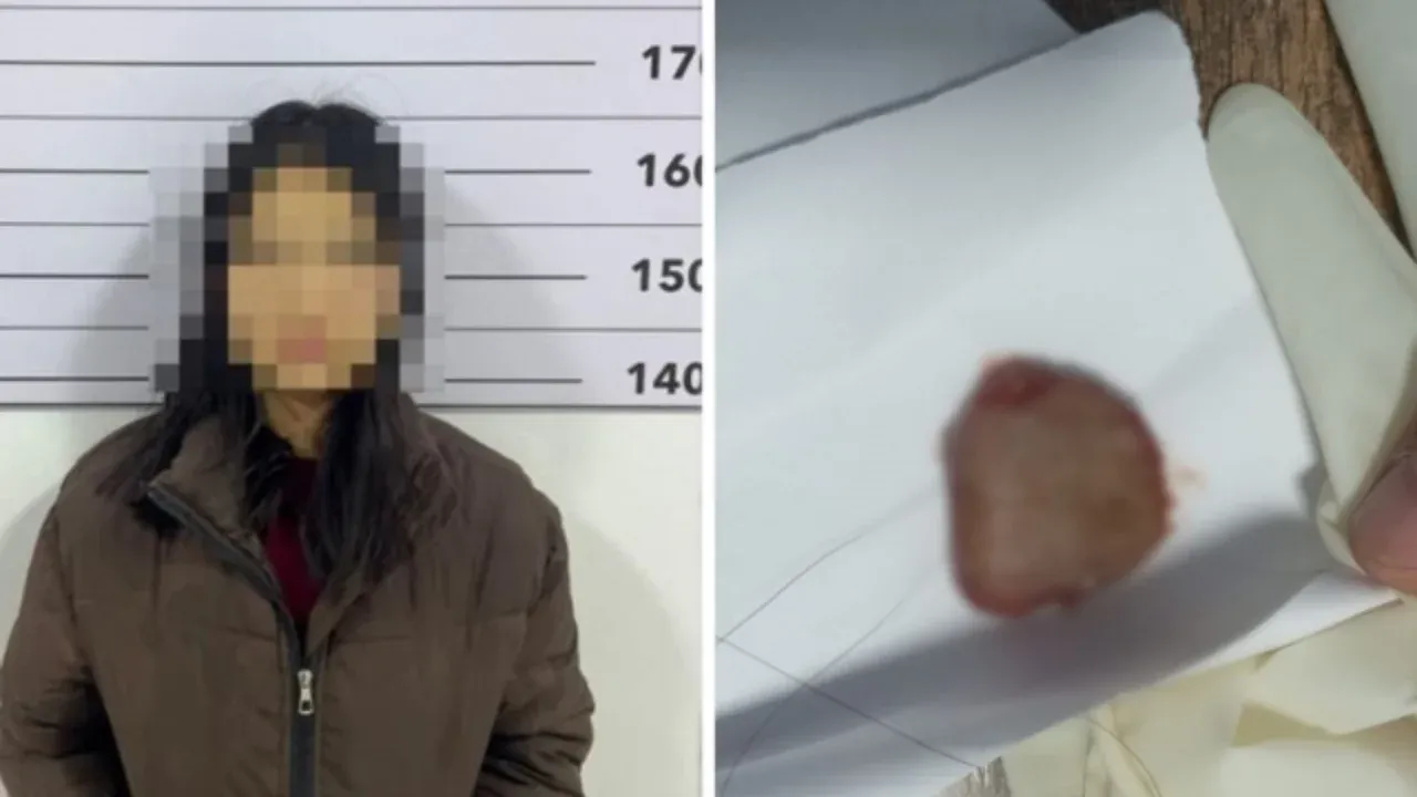 Qirg‘izistonda qiz o‘pish chog‘ida yigit tilini tishladi