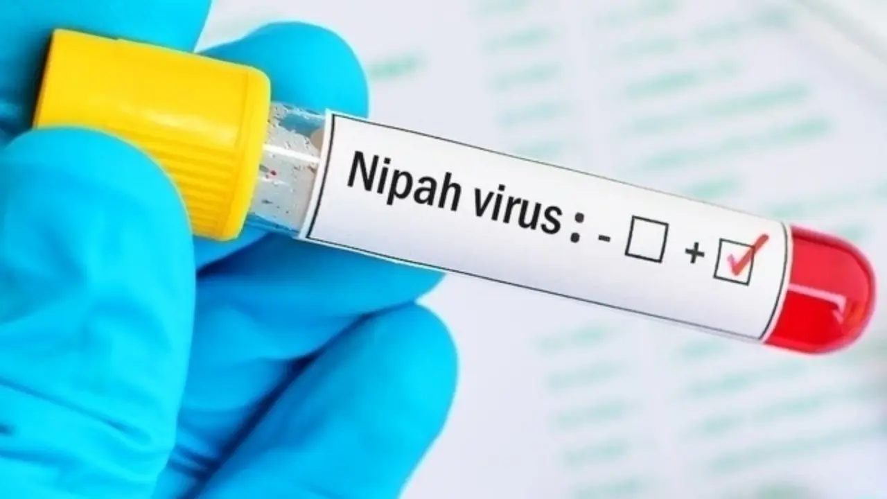 Nipah virusi: O‘zbekistonda xavf yo‘q, ehtiyot bo‘ling!