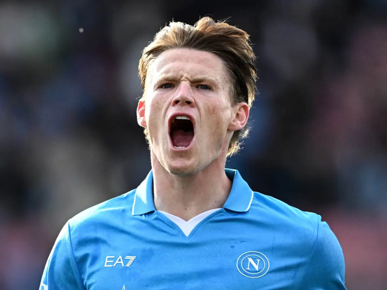 Despite his injury, McTominay continues training