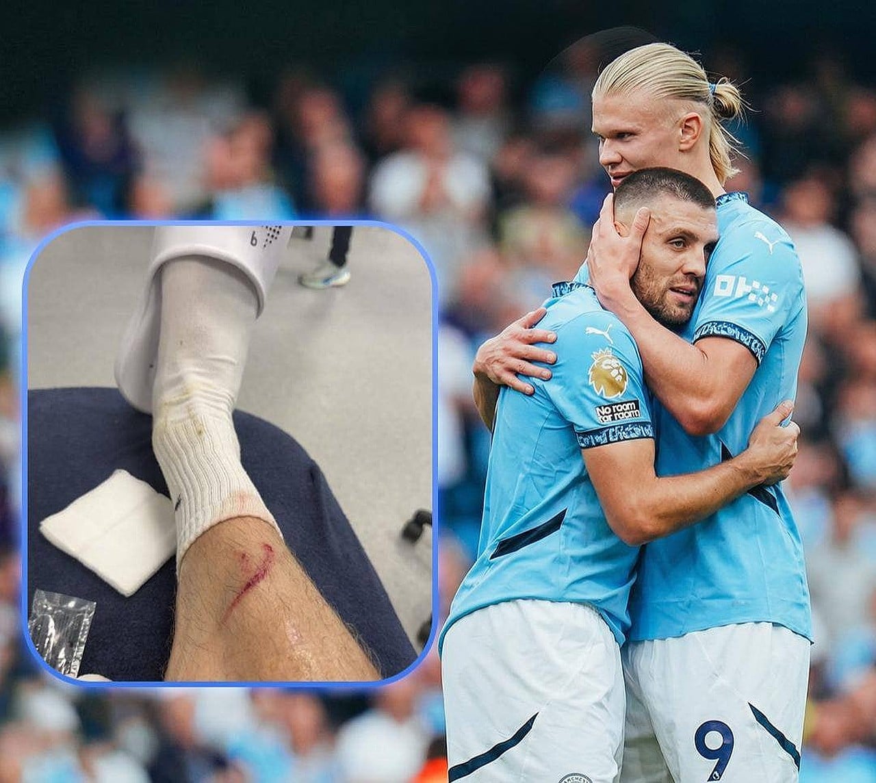 Erling Xoland jarohatini hazil bilan qabul qildi