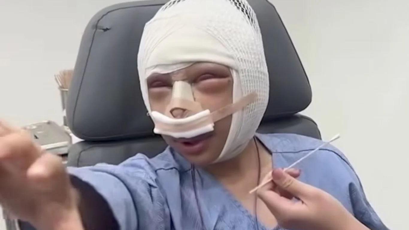 Tashqi ko'rinishi tanqid qilingan ayol plastik jarrohlikka qo'l urdi