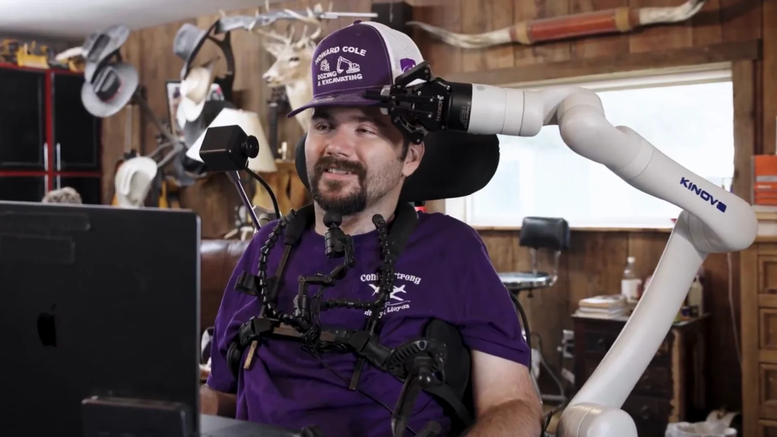 Ilon Maskning Neyralink kompaniyasi fikr kuchi bilan boshqariladigan sun'iy qo'llarni namoyish etdi