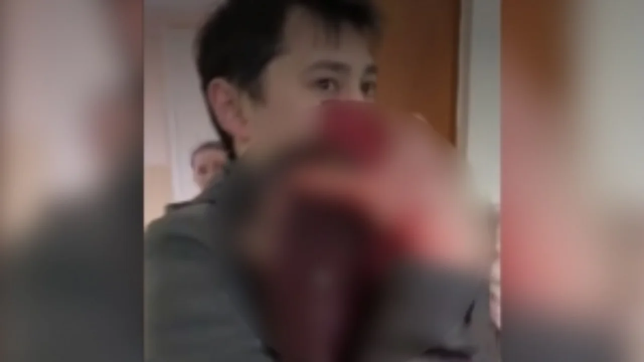 Qozogistonda bino bezagi tushib uch yoshli bola jarohatlandi