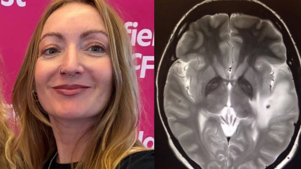 A woman who traveled to India suffered from a parasite for ten years